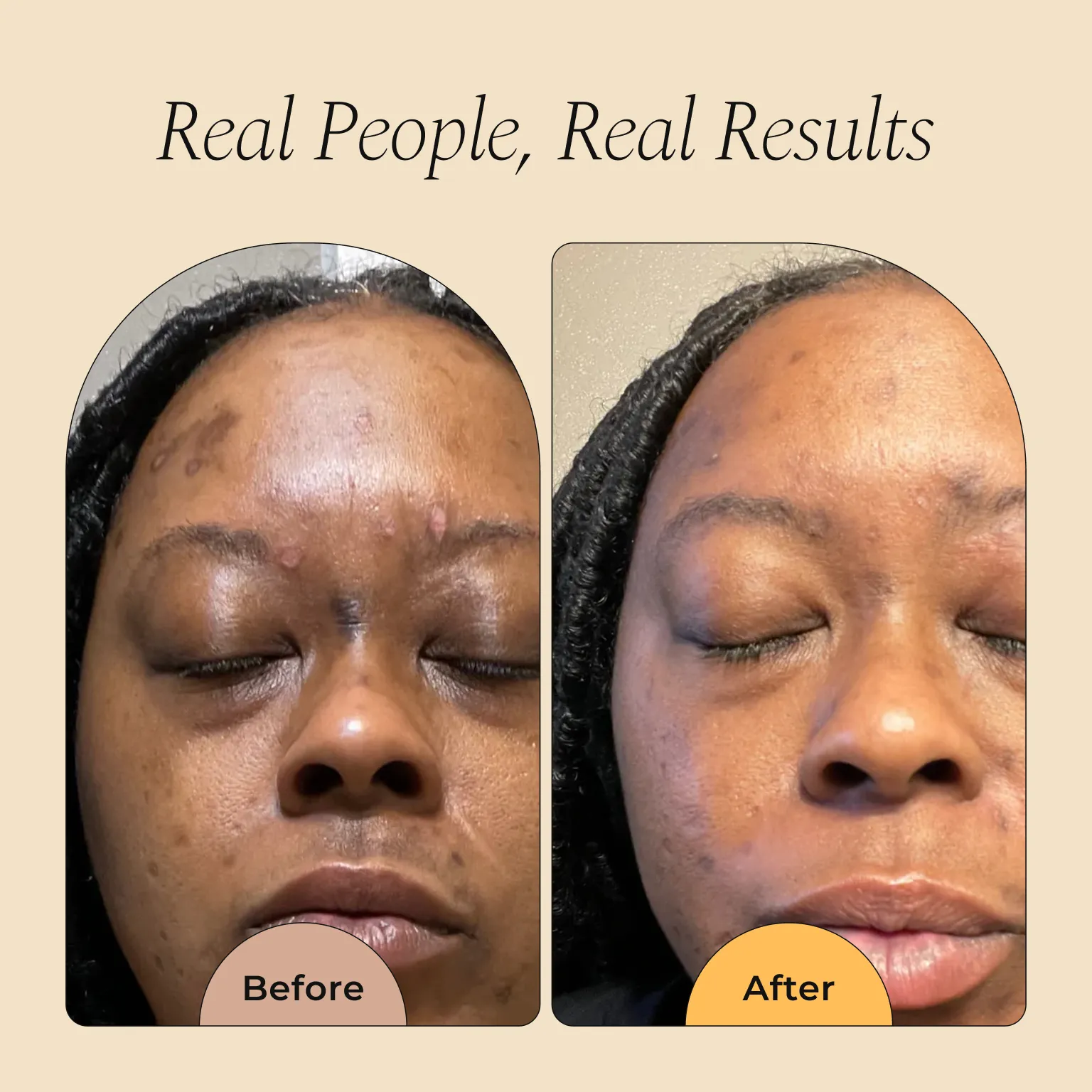 Dark Spot Corrector Serum - Image 4