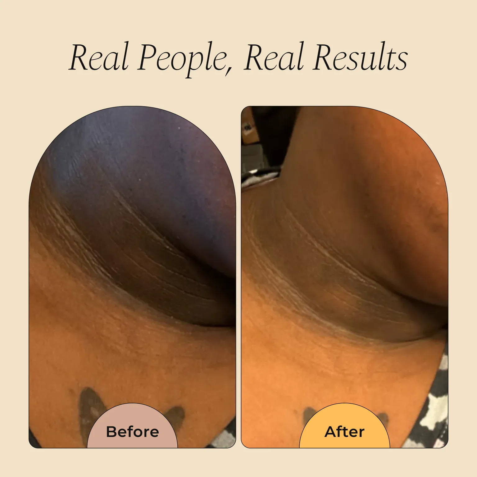 Magic Eraser Dark Spot Cream - Image 4
