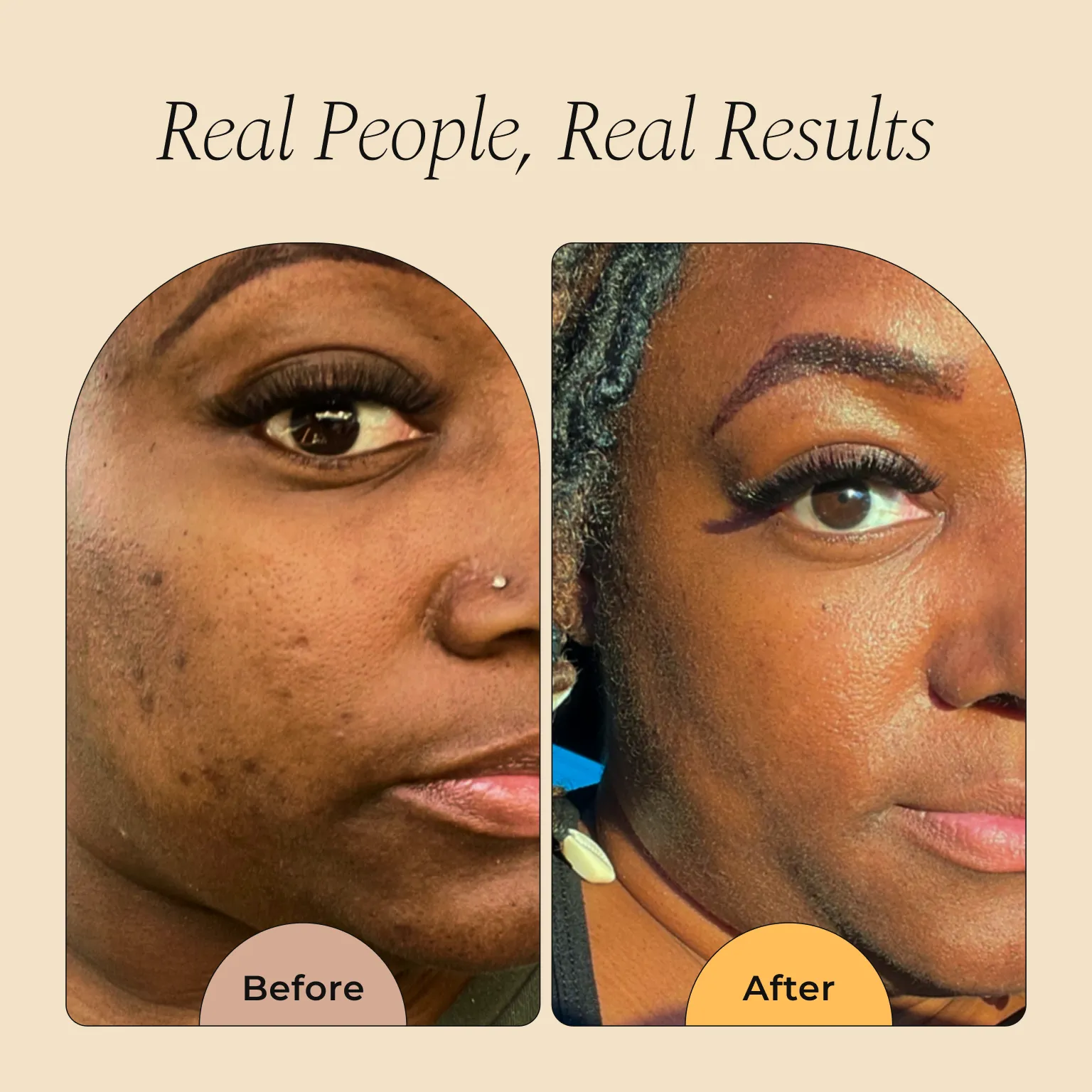 Melanin Skin Bundle - Image 15
