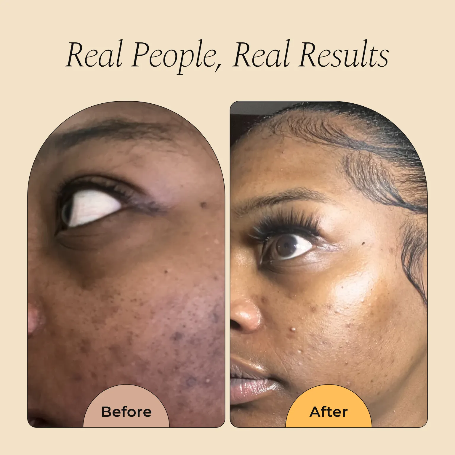 Melanin Skin Bundle - Image 16