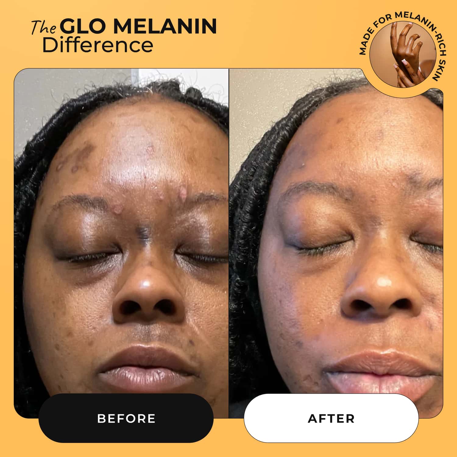 Melanin Skin Bundle (40% off) - Image 3