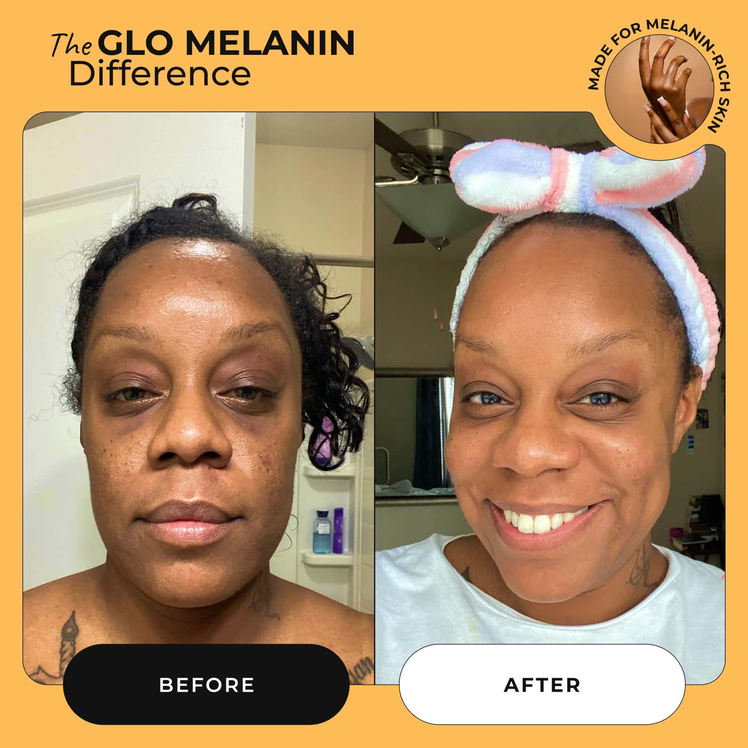 Melanin Skin Bundle (40% off) - Image 4