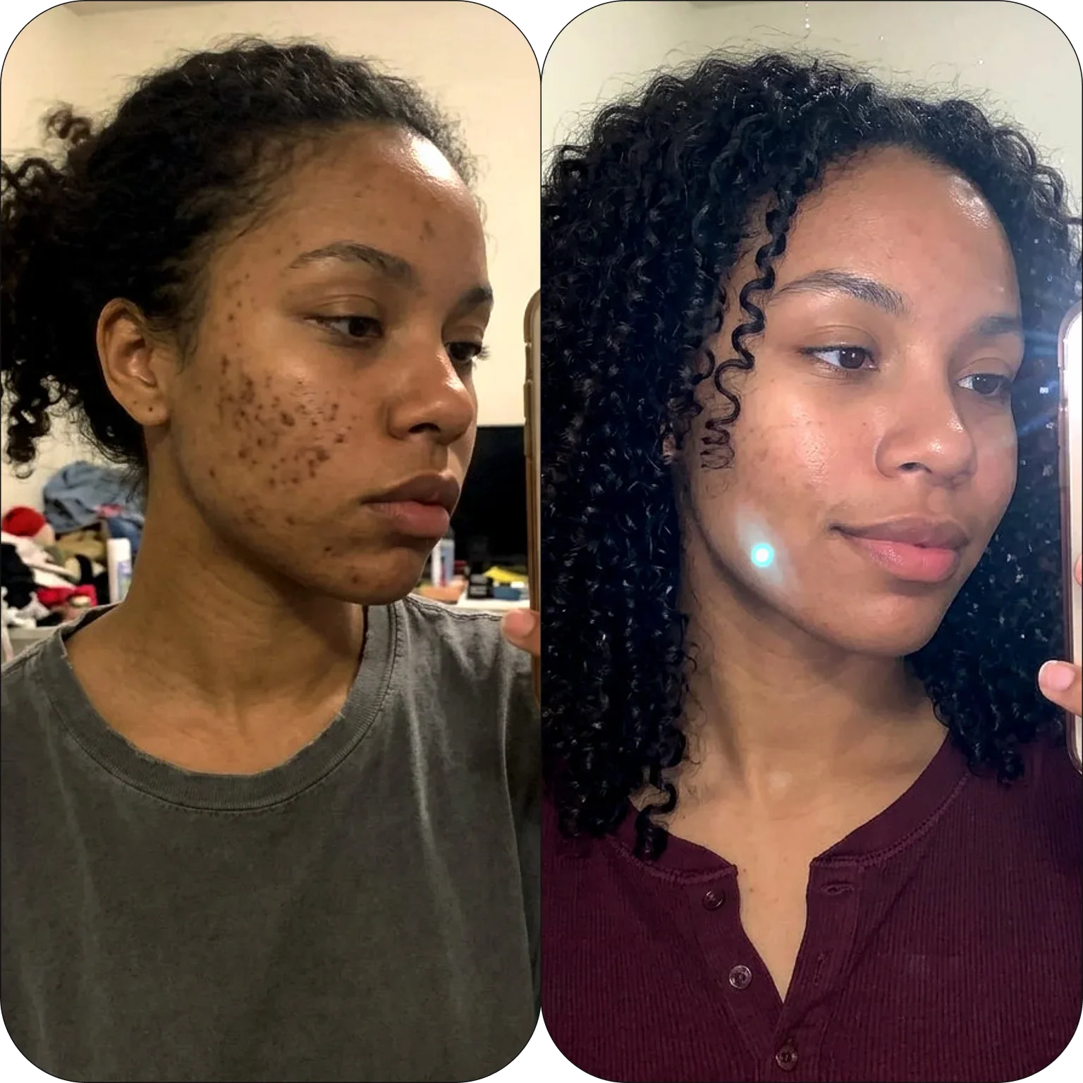 Sea Moss Wrapping Mask with Turmeric & Kojic Acid - Image 6