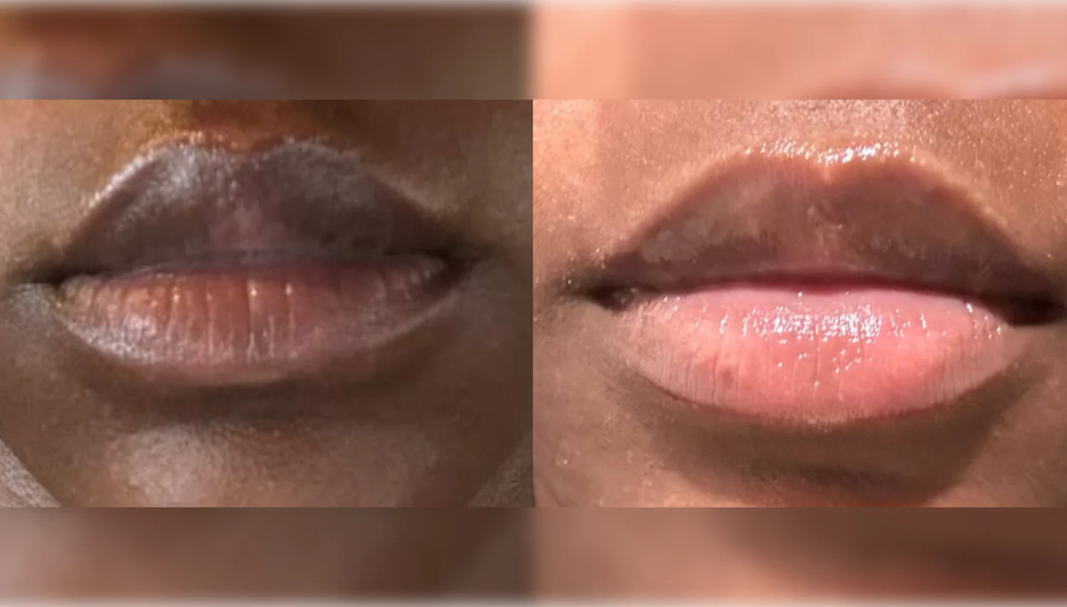 Brightening Lip Bundle - Image 3