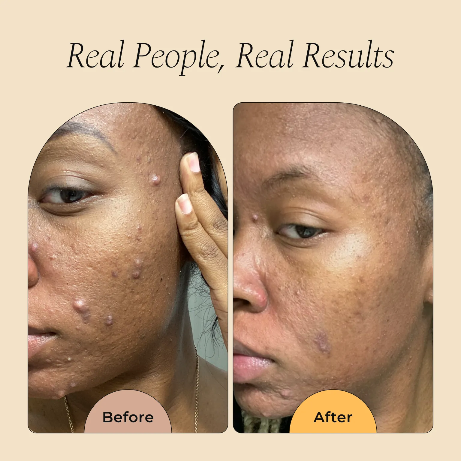 Turmeric and Kojic Foaming Face Wash - Image 4