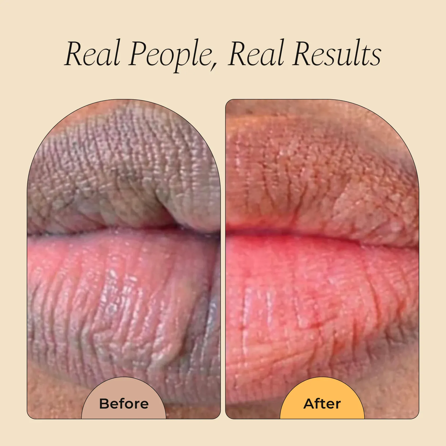 Turmeric and Lemon Lip Balm (for Dark Lips) - Image 4